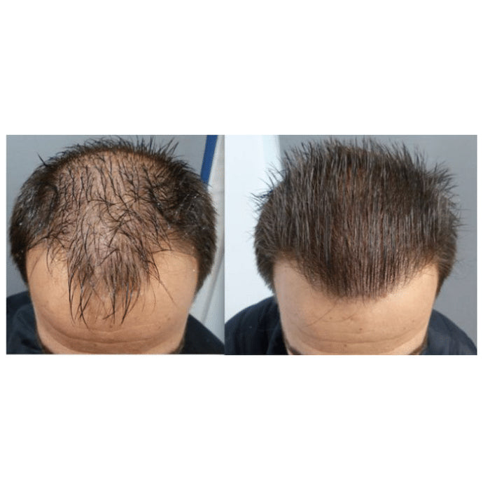 Tinfal Plus Solution