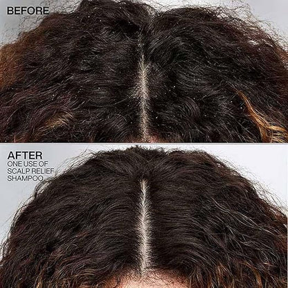 Redken Scalp Relief Anti-Dandruff Shampoo With Pyrithione Zinc