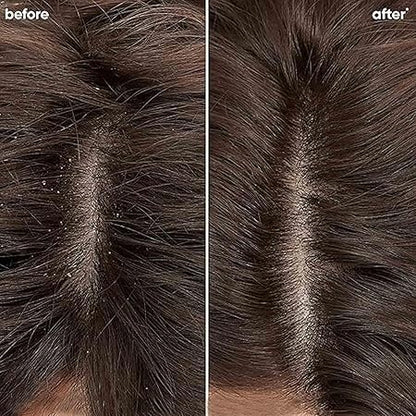 Biolage Professional Scalppure Anti-Dandruff Shampoo,