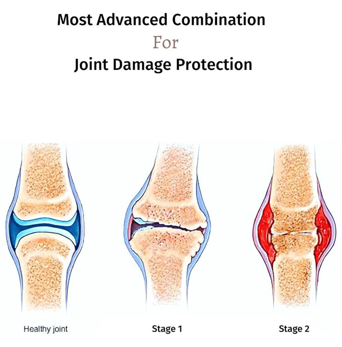 Buy Regenflex C2-Undenatured Type II Collagen,Hyaluronic acid,Boswellia ...